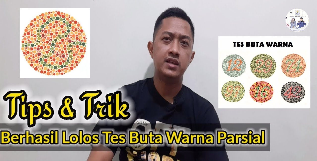 Kondisi Buta Warna Parsial Lebih Sering Terjadi Pada Laki-Laki