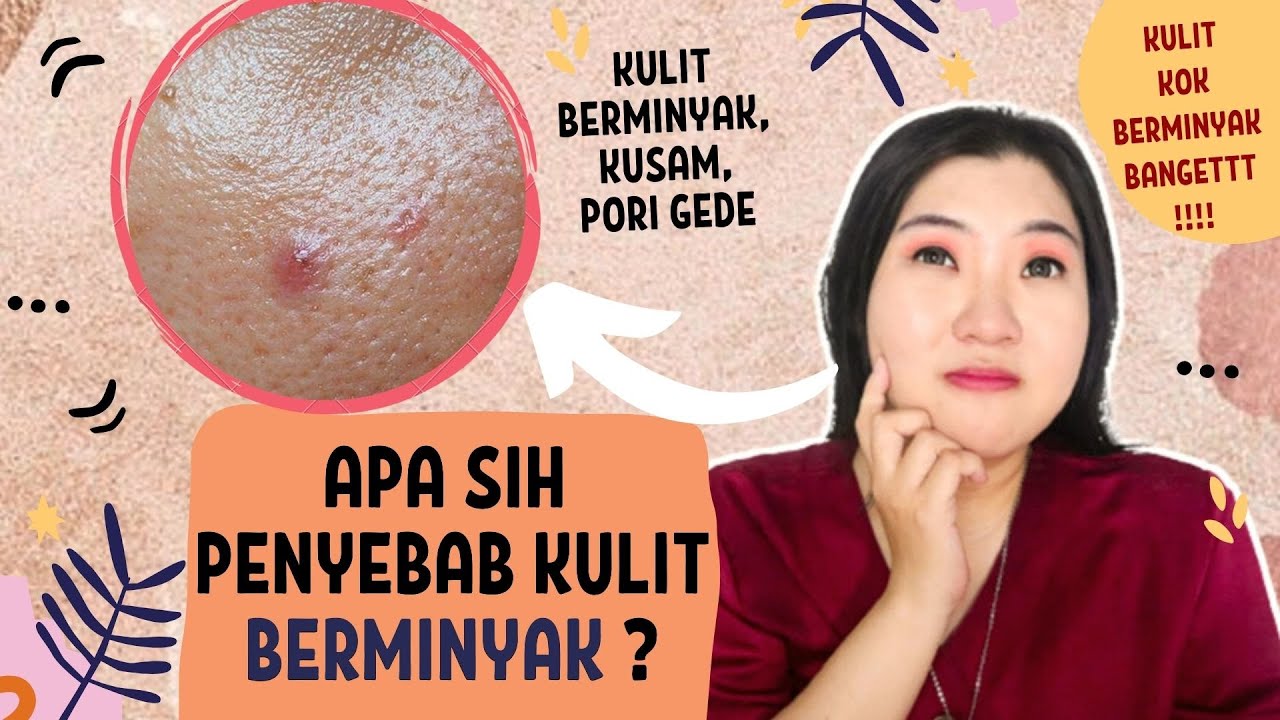 Ternyata Kulit Yang Berminyak Pada Wajah Bisa Karena Genetika