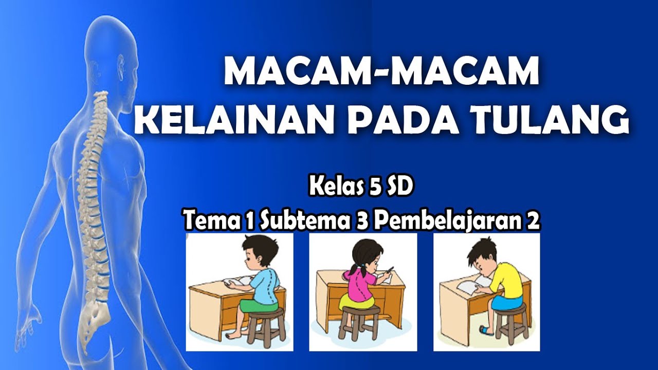 Kondisi Kelainan Pada Tulang Yang Harus Sering Di Perhatikan