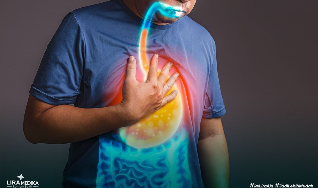 GERD Tak Sekadar Lambung, Kesehatan Mental Juga Berperan