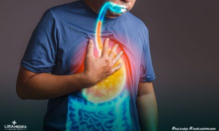GERD Tak Sekadar Lambung, Kesehatan Mental Juga Berperan
