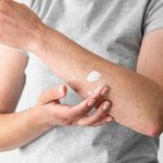 Referensi Obat Panu Yang Ampuh Untuk Anda Coba