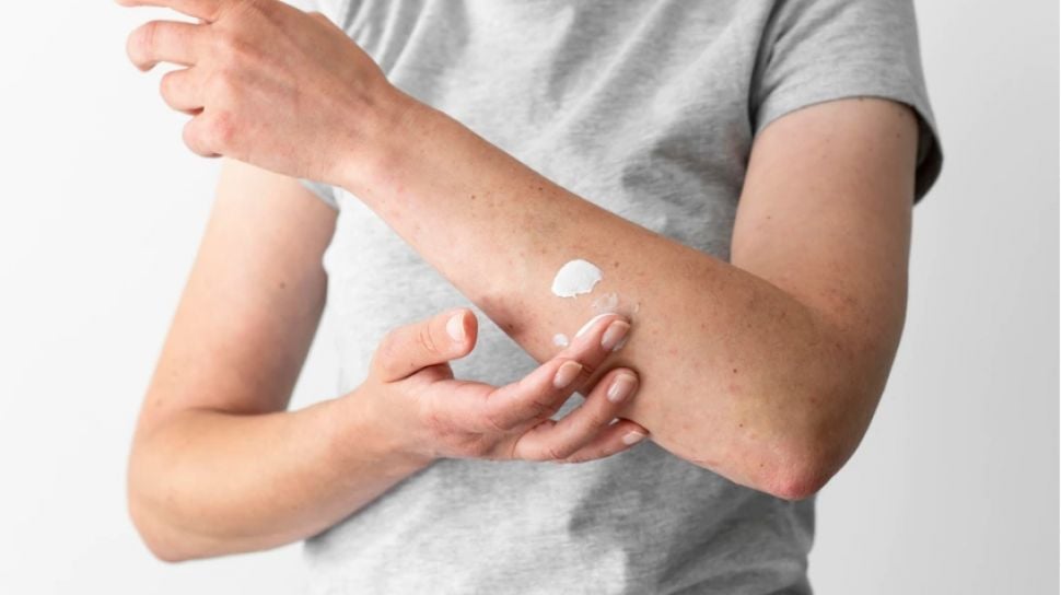 Referensi Obat Panu